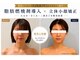 アセンド(ASCEND)の写真