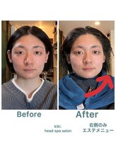 キキ(kiki.)/お肌のトーンアップもヘッドスパ