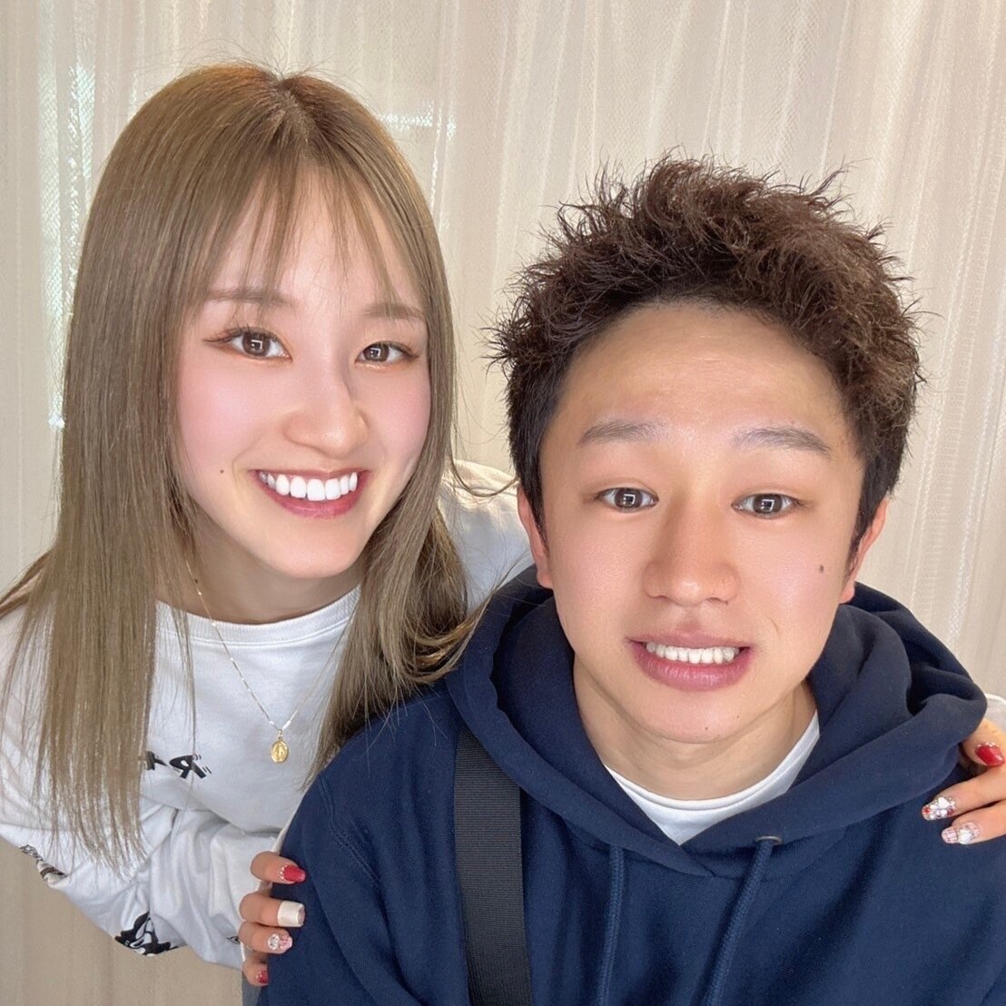 ホワイトニング施術前後の比較写真 症例01