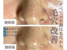 ホワイト ターコイズ
