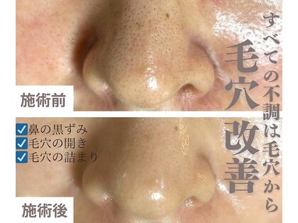 ホワイト ターコイズの写真