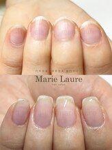 マリーロール 梅田店(Marie Laure)/深爪矯正/自爪育成/自爪風