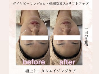 カラン(Calin)/50代前半お客様☆