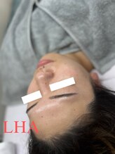 ヌン(NUN.)/ララピーリング