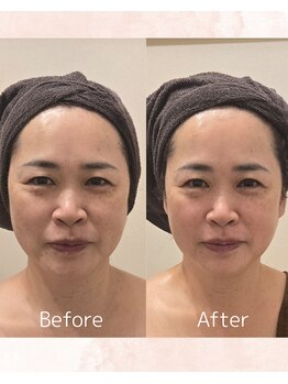 クリニカルスイート エーアール(Clinical sweet.ar)/若見え引き締めトータルケア