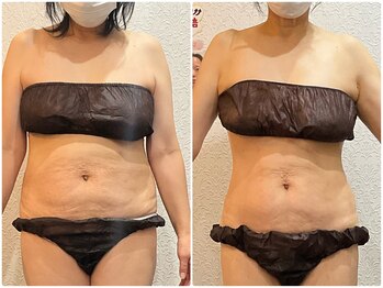 美容整体ウェリナ 名駅院/小顔矯正/骨盤矯正/美脚サロン