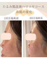 シンナリ(Shinnari)/お肌の変化