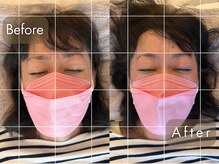 整体サロン イチ(ICHI)/頭蓋骨・小顔矯正before/after