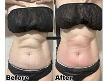 カピリナ(Kapilina)/ WINBACK60 1回【50代前半女性】