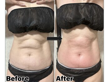 カピリナ(Kapilina)/ WINBACK60 1回【50代前半女性】