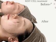 エミィ(emmy)の雰囲気（お肌の細胞を根本から育てるリアボーテ肌質改善フェイシャル）