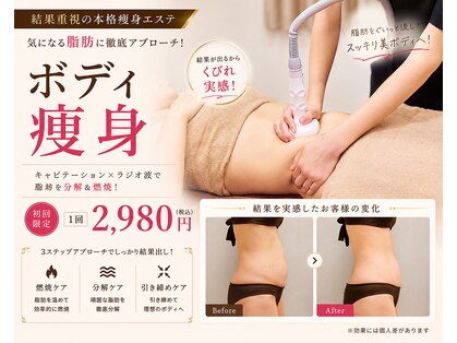 エステティック レイビス 川崎店(RAYVIS)の写真