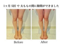 ナチュラーレ 天王寺店(Naturale)/痩身リンパマッサージ二の腕美脚