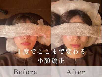 雲上の休息の写真