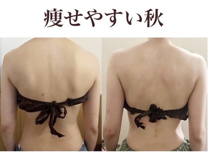 トニートニー(Tony Tony)の写真