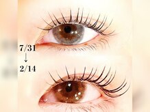 シックビューティバー(Chic Beauty Bar)/ラッシュアディクト経過