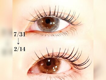 シックビューティバー(Chic Beauty Bar)/ラッシュアディクト経過