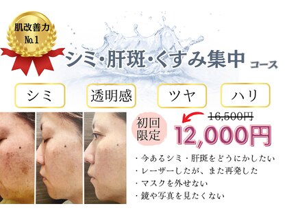 ビューティーワンド ココ(Beauty Wand COCO)の写真