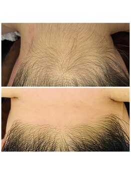 エリー(ERIE)/うなじWax（艶肌Wax)