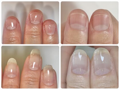 フェミニンネイル(Feminine Nail)の写真