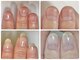 フェミニンネイル(Feminine Nail)の写真