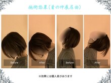 ボディ リセット アンド デザイン(Body Reset & Design)/【施術例】ビフォーアフター