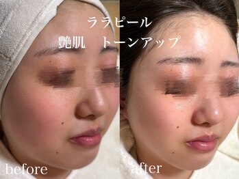 ネオリー(neorii)/ララピール