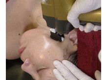 ブリエ 自由が丘(briller)/4-4)　ACトリートメント