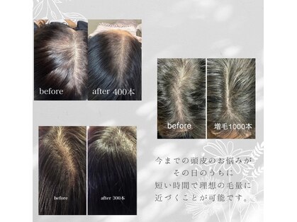 ビューティーサロンフルール(fleur)の写真