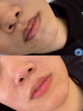 アネモネ ビューティーズ サロン(Anemone Beauty's salon)/ドールピンクBefore→After