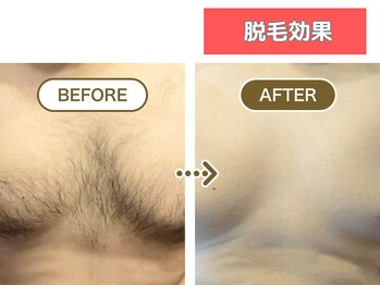 HGB 東山公園駅前店/男性｜40代｜自営業