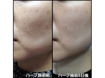 グレイス(Grace)の写真