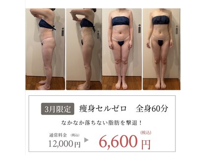 リモアボーテ(RIMOA beaute)の写真