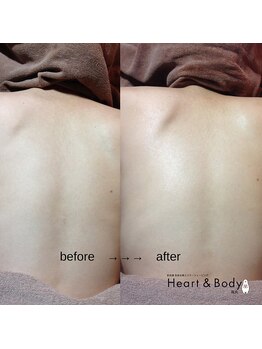 ハートアンドボディ 烏丸店(Heart&Body)/背中美人に