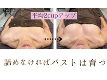ハーズプラス(hers+)