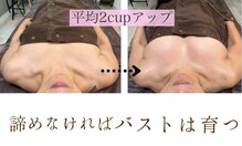 ハーズプラス(hers+)