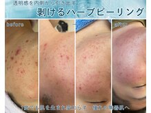 ラウレア オハナ(Laulea ohana)の雰囲気（肌質改善ピーリング多数。お肌悩み是非ご相談下さい）