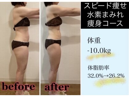 ヨサパーク レナータ(YOSA PARK Renata)の写真