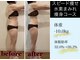 ヨサパーク レナータ(YOSA PARK Renata)の写真