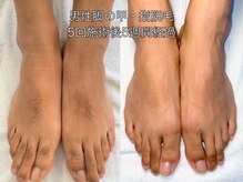 エクレ 柏店(EKURE)/メンズ脚脱毛