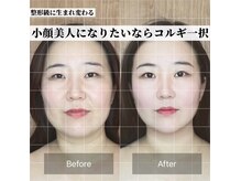 オプレア 栄店(OPREA)の雰囲気（1回でも効果実感がある【小顔コルギ】）