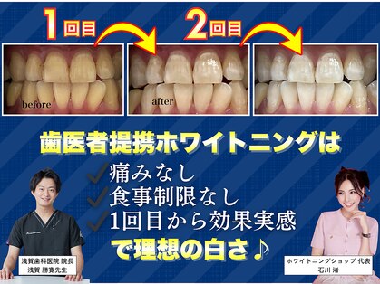 ホワイトニングショップ くずは店の写真