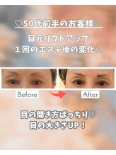 エステサロン 凛/６０歳のお客様です