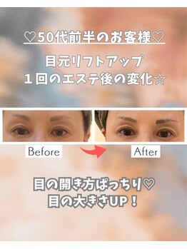 エステサロン 凛/60歳のお客様です