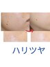 痛みを抑えた光フォト。くすみやシミに特化したシミケア9000円→6500