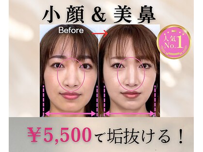 隆鼻矯正専門店 ラプリ(Raplit)の写真