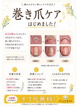にっこりネイル/フット巻き爪ケア♪