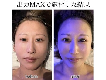 ドクターヴィー 高知(DrVi)/たった一度で目鼻のクッキリ感◎