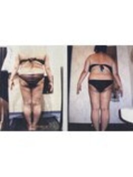 クイーン 天王寺店(Queen)/お客様 ビフォーアフター(3)