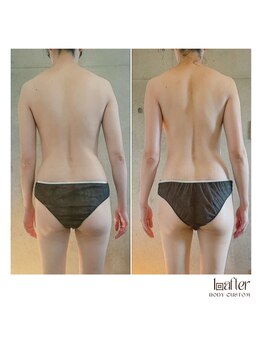 サプナジー(Suppnrgy)/カスタムトリートメント